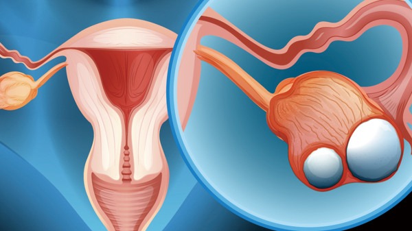 子宫肌瘤的病情如何分级？会带来什么样的危害呢？