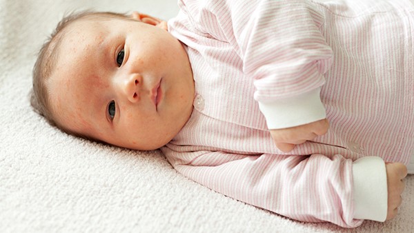 如何预防新生婴儿生痱子？宝宝长痱子如何护理？