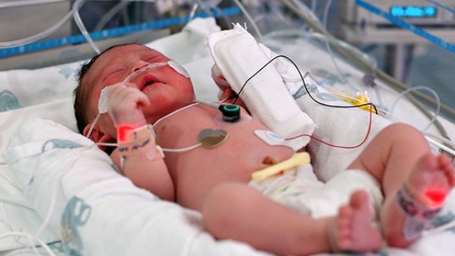 早产儿为什么愈来愈多？哪些方面造成新生婴儿早产？