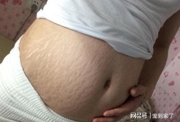 怀孕38周突然长妊娠纹，该怎么办？（怀孕38周突然长妊娠纹怎么办？）
