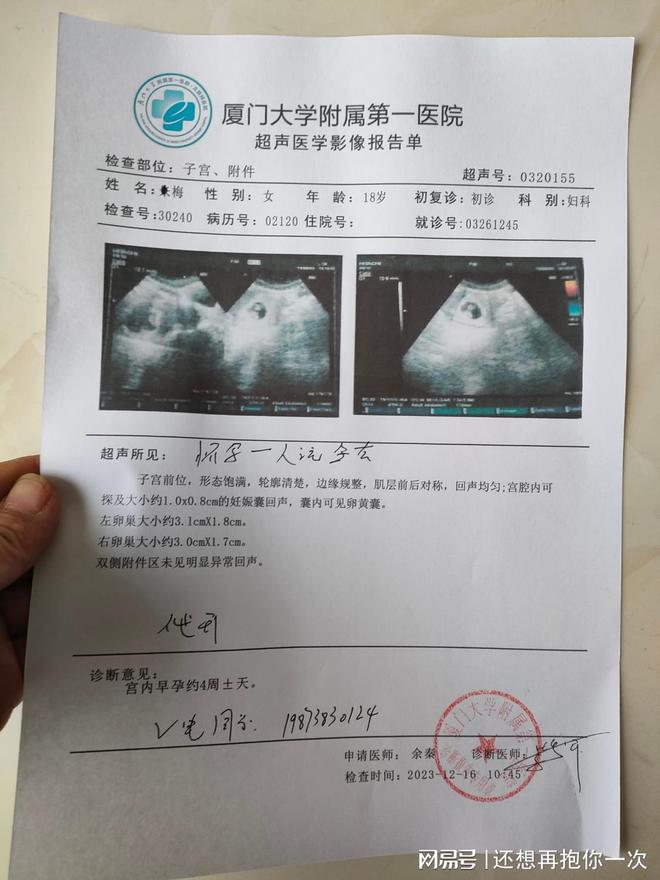 长春南京怀孕血检结扎病例单入院单（）