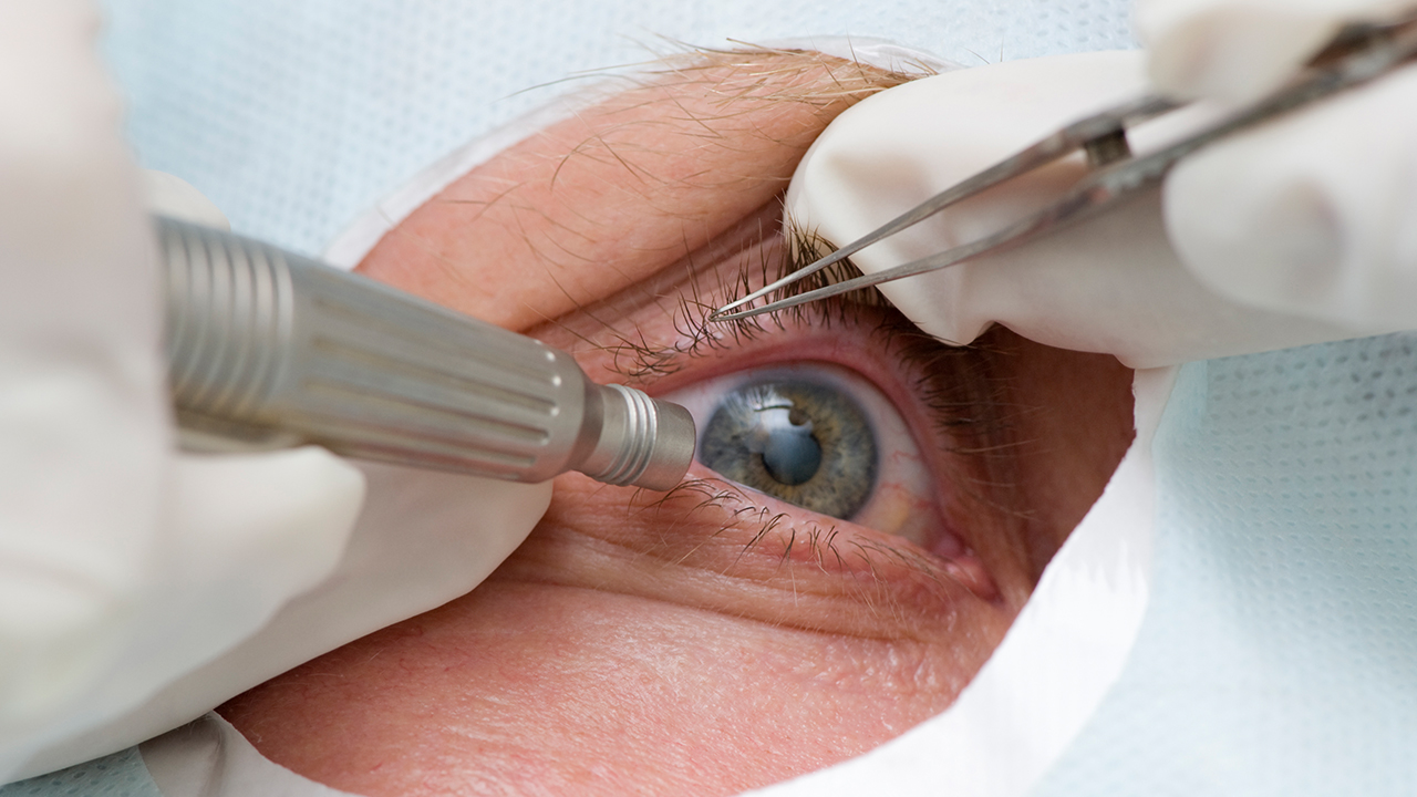 青光眼手术后的视力恢复情况如何？（青光眼手术后的视力恢复）
