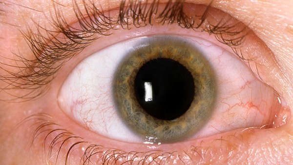 做近视眼手术都有干眼症吗