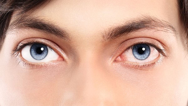 做近视手术会导致干眼症吗