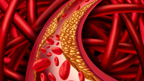 贫血性梗死常发生于哪些器官