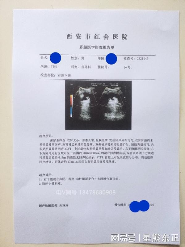 凯里都匀兴义福泉怀孕血检报告病历单怀孕血检怀孕血检5周8周尿检