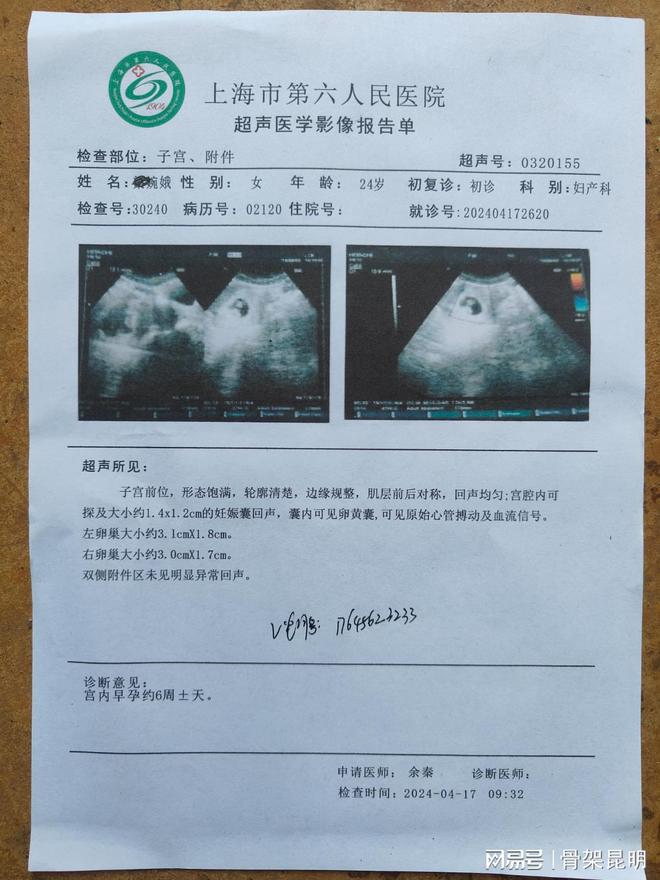黄山六安池州减少怀孕唐氏筛查病历怀孕B超风湿性关节炎入院病历