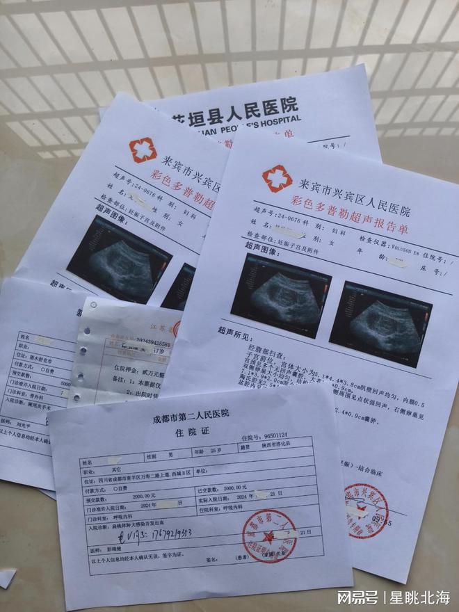衢州金华医院怀孕验血判断怀孕方法及4周-周5人流病历打胎手术单
